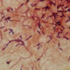 It also lives in the environment, such as in soil, water, and animal feces. Clostridien Doccheck Flexikon