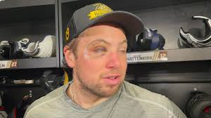 Charlie McAvoy is undergoing testing related to an upper body injury  sustained in the 4 Nations tournament game against Canada and will not play  in Thursday's championship game, per the Boston Bruins