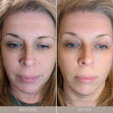 Renaisskin Aesthetics