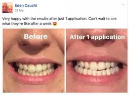 Pin On Teeth