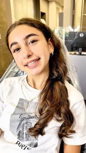 Check out our #shapememoryaligners in action , Starting treatment. Part 1 ,  Watch for updates #follow #followformoreposts #aligners #beforeandafter  #drkovalorthodontics #airwayorthodontics #boca