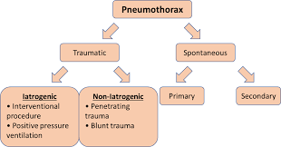 Image result for Open Pneumothorax