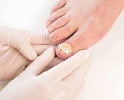 The skincare experts at dfw laser aesthetics implement a diverse array of techniques, from botox and chemical peels to permanent makeup and tattoo removal. Dfw Laser Aesthetics Dfw Laser Aesthetics Offers The Latest In Skin Care Technology In The Dallas Fort Worth Surrounding Areas