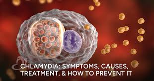 Image result for chlamydia symptoms