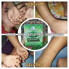 Maybe you would like to learn more about one of these? Tak Tahu Dekat Mana Nak Cari Daun Mommycare Putrajaya ÙÙŠØ³Ø¨ÙˆÙƒ