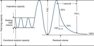 Spirogram With Volumes And Measurements Respiratory