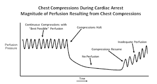 Image result for Chest Compressions