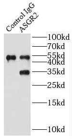 When ready to use, rehydrate with dh2o (50 µl for 100 µg antibody or 250 µl for 500 µg antibody) to make 2 mg/ml solution and. Monoclonal Asgpr Antibody Search Results Mybiosource