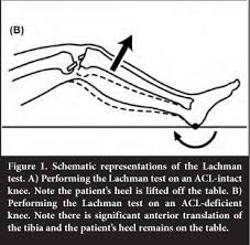Image result for Lever Test