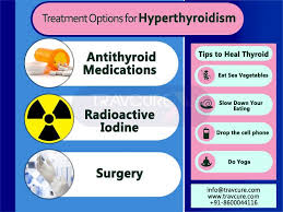Image result for Hyperthyroidism Management
