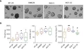 Un diagnostic si o optimizare fiscala corecta a celor doua forme de realizare a veniturilor. Frontiers Physical Characterization Of Colorectal Cancer Spheroids And Evaluation Of Nk Cell Infiltration Through A Flow Based Analysis Immunology