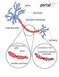 Sclerosis multiple), to przewlekła, zapalna choroba, atakująca układ nerwowy, powodująca uszkodzenie tkanki nerwowej. Stwardnienie Rozsiane Sm Portal Fizjoterapeuty