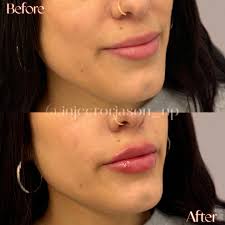 Jason Tye DNP, FNP-c (@injectorjason_np) • Instagram photos and videos