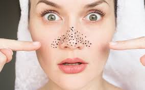 We did not find results for: Komedo Hitam Blackheads Penyebab Dan Cara Mengatasi