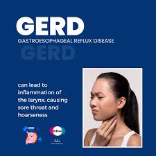 Image result for Reflux Laryngitis