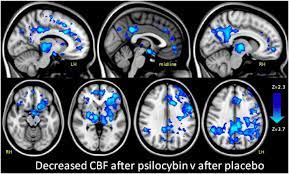 Fmri Scans Reveals How Magic Mushrooms Inflict Psychedelic Effect On The Brain