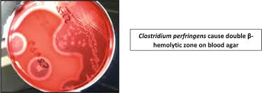 Clostridium perfringens grown anaerobically on blood agar at 37 ° c for one day. Cultivation Of Anaerobic Bacteria In Canned Food Springerlink