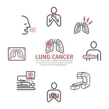 Let's talk about lung cancer signs and symptoms. Lung Cancer Banner Symptoms Causes Treatment Line Icons Set Vector Signs For Web Graphics Stock Vector Illustration Of Breath Healthcare 158132168
