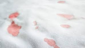 Utilisez un linge imbibé d'un peu d'ammoniaque. Taches De Sang 6 Astuces Naturelles De Grand Mere Grands Mamans Com
