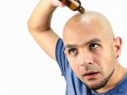 Hair loss forums for men, women, and people seeking information on alopecia, transplants, and hair replacement. Get Rid Of Permanent Hair Loss With These Advance Treatments Times Of India