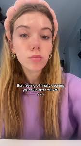 Katelyn Mcnally's Instagram, Twitter & Facebook