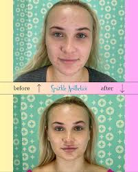 It is with profound sadness that we announce the passing of our beloved  owner, Dani Sher. Dani was the sparkliest person in every room she entered  and the mastermind behind Sparkle Aesthetics.