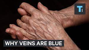 As a result, the valves in the veins weaken, and blood flows backward. Your Blood Is Red So Why Are Your Veins Blue Youtube