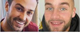 Dave roelvink heeft ´nieuwe´ tanden laten zetten in een kliniek in turkije. Ook Dave Roelvink Laat Zichzelf Zien Zonder Neptanden Shownieuws