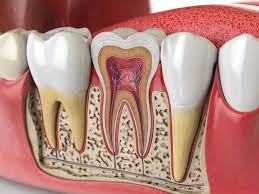 Image result for Tooth Luxation