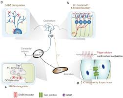 Image result for Essential Tremor