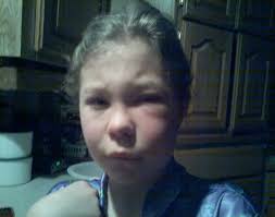 Deadly Dentistry: Beating the System