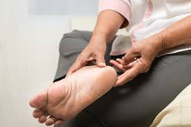 Mimo to każdego roku w polsce wykonuje się około 6000 amputacji kończyn dolnych u cukrzyków. Rodzaje Stopy Cukrzycowej Forum Leczenia Ran