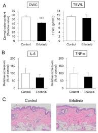 Maybe you would like to learn more about one of these? Epidermal Growth Factor Receptor Tyrosine Kinase Inhibitor Erlotinib Induces Dry Skin Via Decreased In Aquaporin 3 Expression Researcher An App For Academics