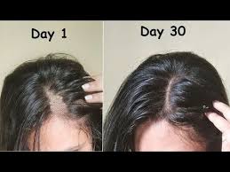 Thin Hair To Thick Hair In 30 Days Carrot Flaxseed Aloevera Gel For Hair Growth Long H Hair Growth Home Remedies Long Hair Treatments Thick Hair Styles