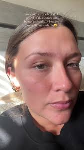 How to Get Rid of Texture and Bumps