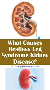 6 Insane Ideas Kidney Disease Pictures Images Medical Management Of Chronic Kidney Disease Can Y Kidney Disease Symptoms Kidney Disease Kidney Disease Recipes