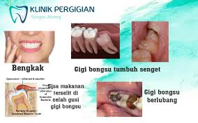 Gusi yang bengkak berarti pada gusi tersebut terjadi peradangan atau inflamasi sehingga warnanya menjadi lebih merah, menonjol, dan kadang terlihat kekuningan di ujungnya sebagai tanda adanya. Klinik Pergigian Sg Abong Dah Umur 20an 30an Pun Masih Ada Gigi Tumbuh Jangan Terkejut Kalau Tiba Tiba Datang Cek Gigi Doktor Beritahu Ada Gigi Yang Nak Tumbuh Hehe Gigi Kekal Di