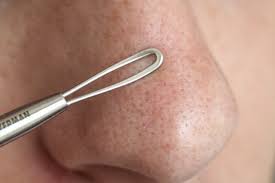 Pin On Skin Care
