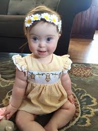 Timeline Photos Kids With Down Syndrome Beautiful Children Down Syndrome Kids Cute Little Baby