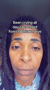 Forestwhitakereye