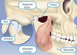 Study Tmj In Fibromyalgia And Chronic Fatigue Syndrome Chronicfatigueyoga Chronic Fatigue Symptoms Chronic Fatigue Syndrome Chronic Fatigue Syndrome Symptoms