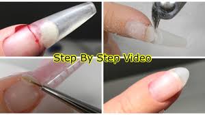 Gel nails, and acrylic nails for that matter, should not hurt at all. Fix A Broken Nail The Correct Way I Remove The Broken Nail Sculpt A Short Gel Extension Youtube