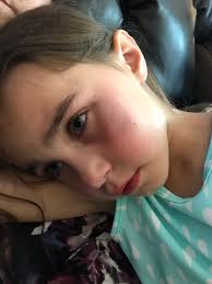 Dangers of bouncy beds for children's spine health