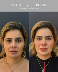 ✨ Autoestima e saúde mental caminham juntas. Cuidar de você não é vaidade —  é autocuidado, é bem-estar, é permitir-se viver com mais leveza e  confiança. Quando você se olha no espelho