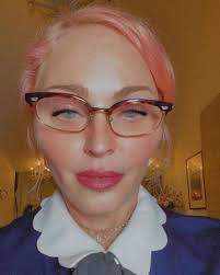 Madonna Nin Son Goruntusu Sasirtti Magazin Haberleri Dunyadan Haberleri
