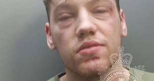 Drunk man used his teeth as a 'weapon' in fight outside pub after smashing  girlfriend's car