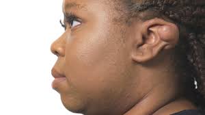 The Bad Skin Clinic • Season 1