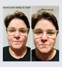 When will the Clarifying Anti-Blemish Face Wash be available?