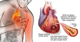 Anda mungkin pernah merasa saat jantung berdebar atau berhenti berdetak apakah itu tanda berbahaya? Gaya Hidup Picu Penyakit Jantung Silampari Online