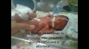 24 semanas de gravidez e a gestante começa aperceber uma sensação muito maluca chamada braxton hicks. O Que Esperar De Um Bebe Que Nasce As 24 Semanas Baby Development
